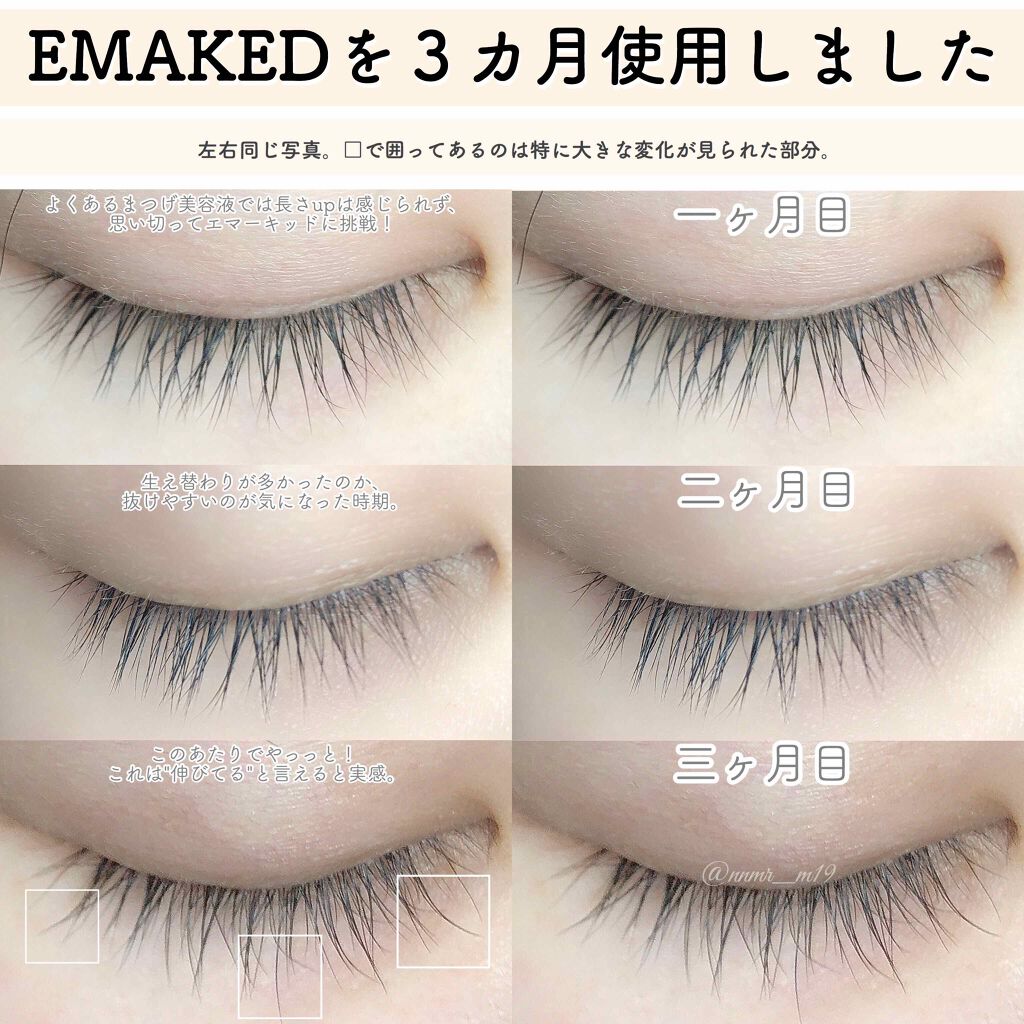 【新品未開封】エマーキット まつ毛美容液 2ml 3本セット【正規品】定価1本6050円購入日