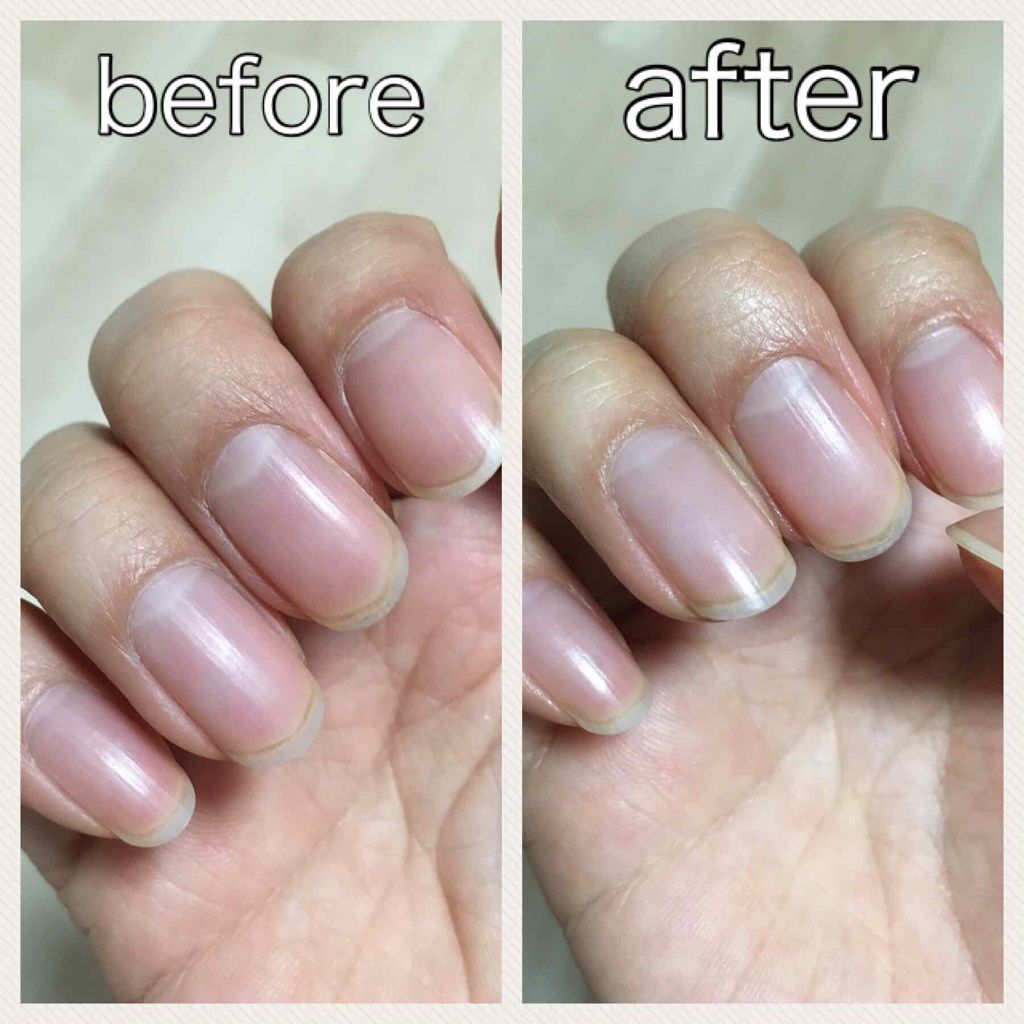 甘皮ケアオイル/無印良品/ネイルオイル・トリートメントを使ったクチコミ(3枚目)