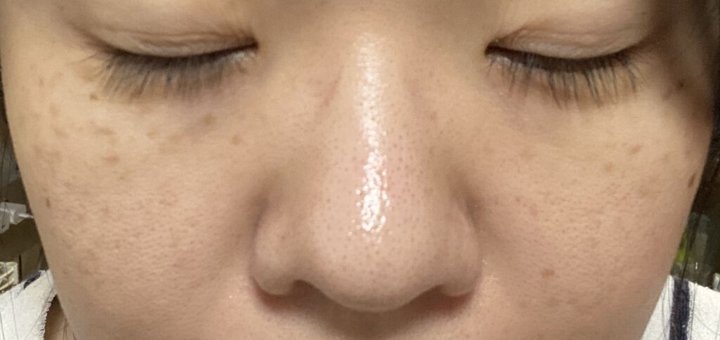 デュオ ザ クレンジングバーム/DUO/クレンジングバームを使ったクチコミ(1枚目)