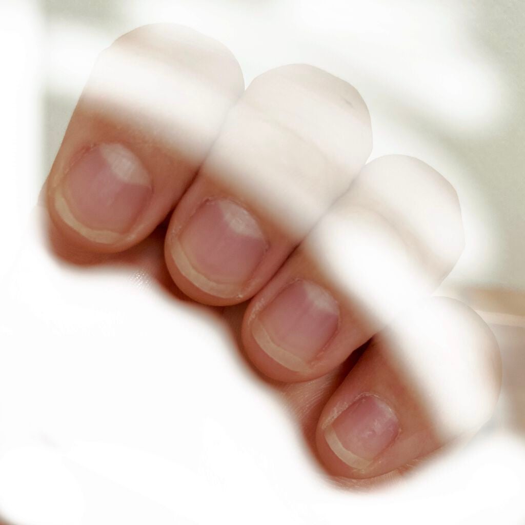 さくまる on LIPS 「お久しぶりです。なんとか噛まずに続行できてます!このままきれい..」(2枚目)