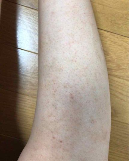 を使ったクチコミ(2枚目)