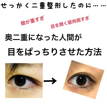 リンクルアイクリーム N なめらか本舗の口コミ 目の撮り方下手ですみません 皆様 いつも By ひなの 混合肌 代後半 Lips