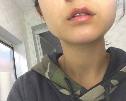 ミラーレスティントルージュ/レディット/リップティントを使ったクチコミ(4枚目)