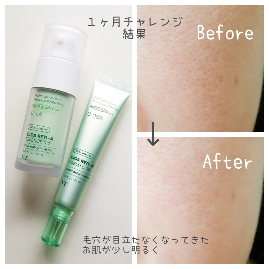 シカレチA エッセンス0.1/VT/美容液を使ったクチコミ（2枚目）