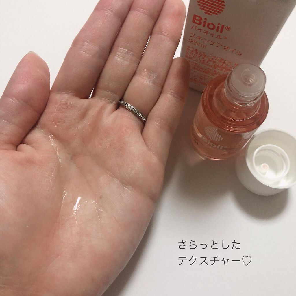 バイオイル/バイオイル/フェイスオイルを使ったクチコミ(4枚目)