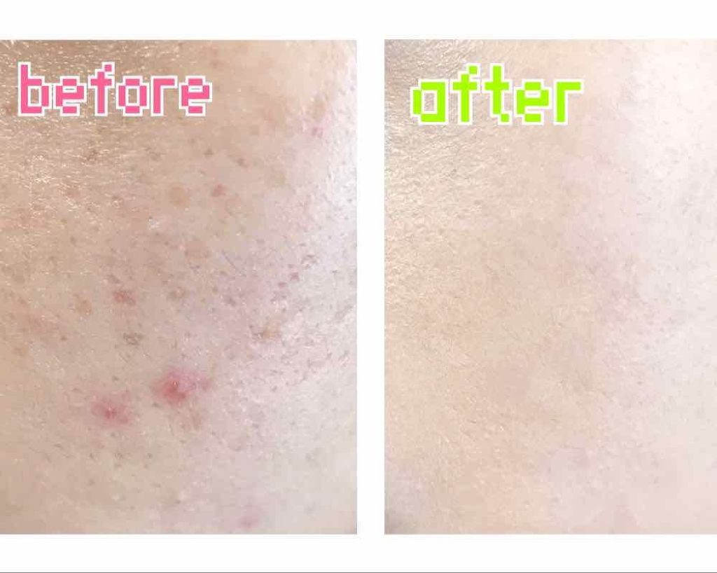 アンクル ド ポー ルクッション/YVES SAINT LAURENT BEAUTE/クッションファンデーションを使ったクチコミ（2枚目）