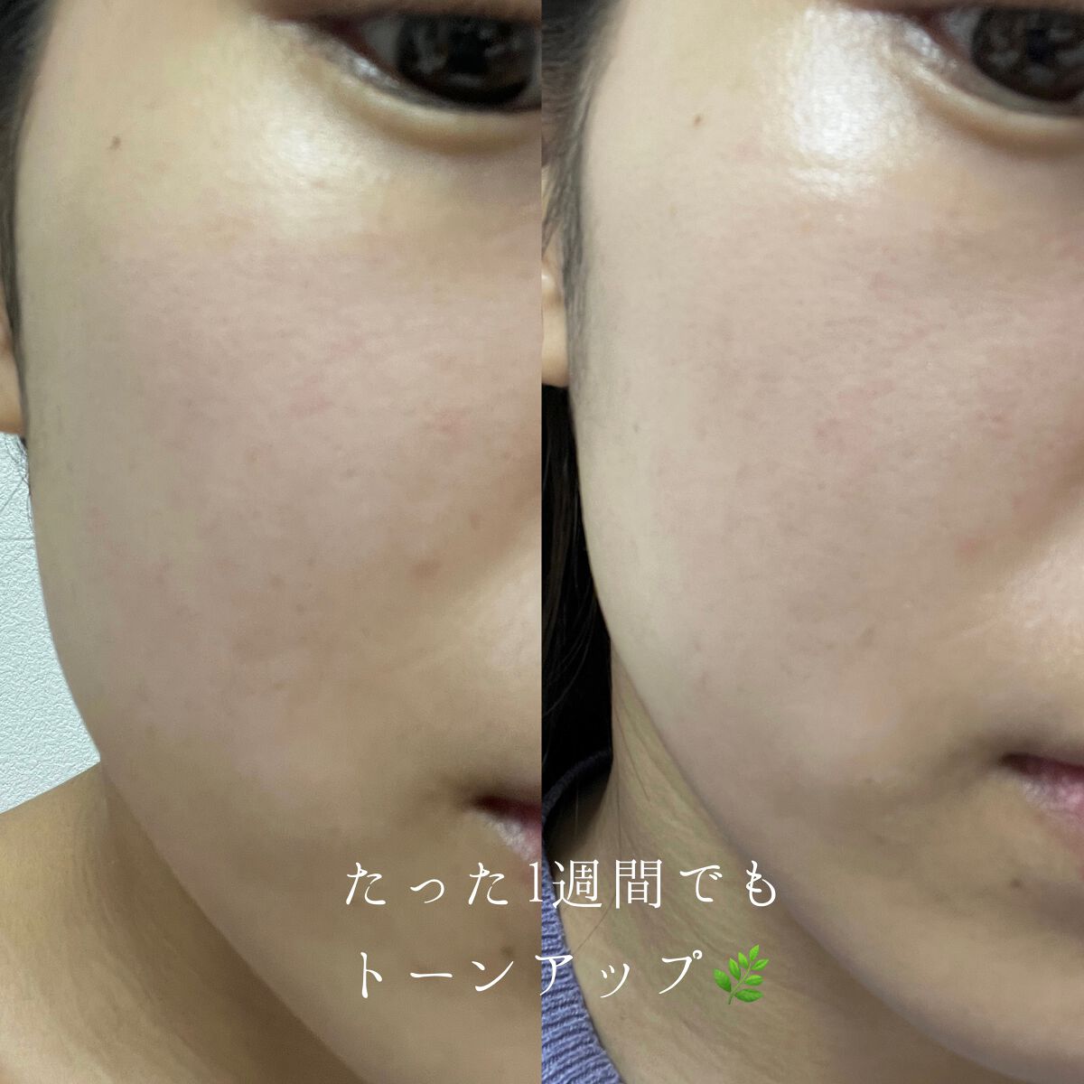 ユース ラディアンス ビタチノール セラム/primera/美容液を使ったクチコミ(6枚目)