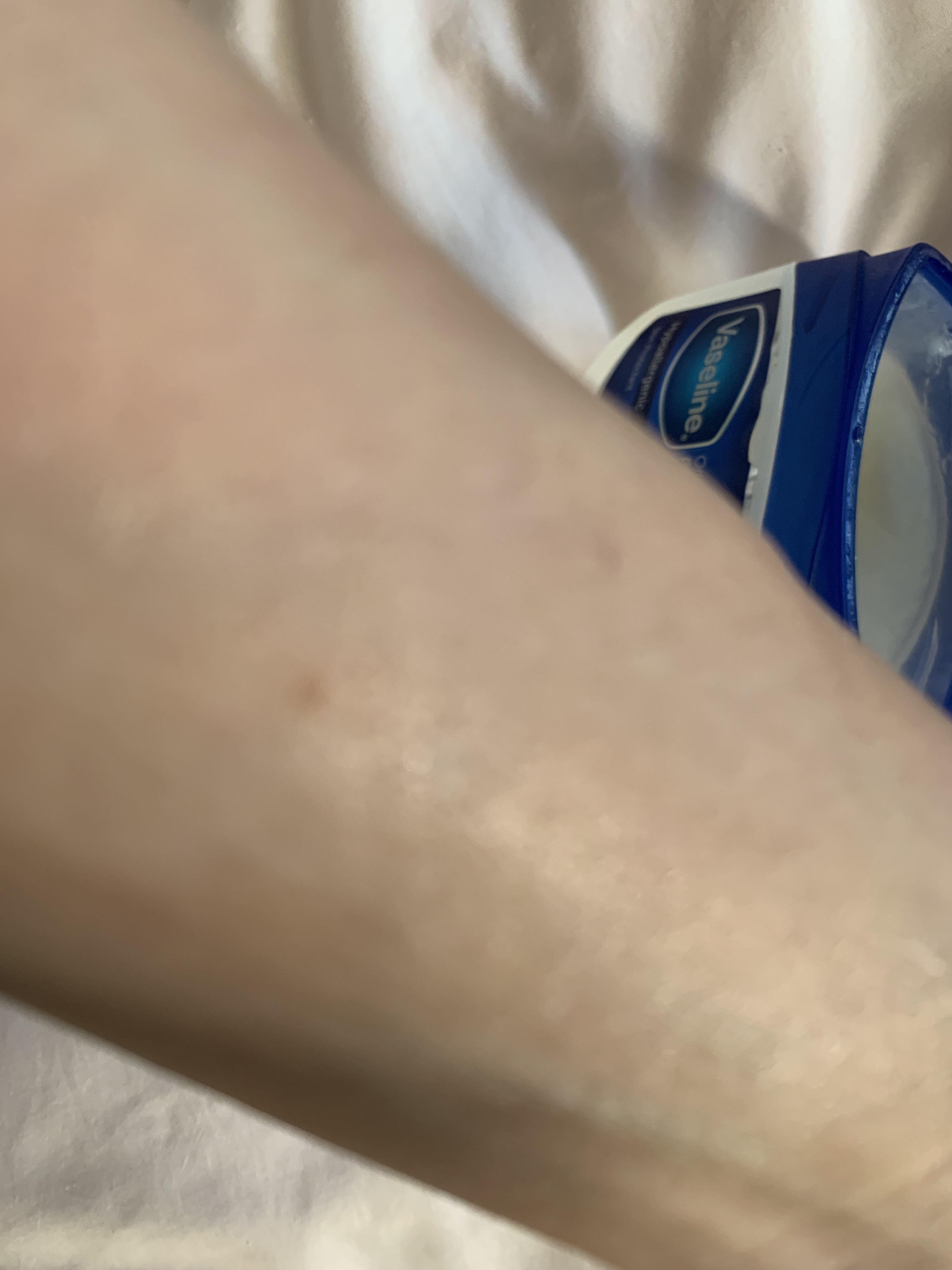 オリジナル ピュアスキンジェリー 200g/ヴァセリン/ボディクリームを使ったクチコミ（3枚目）