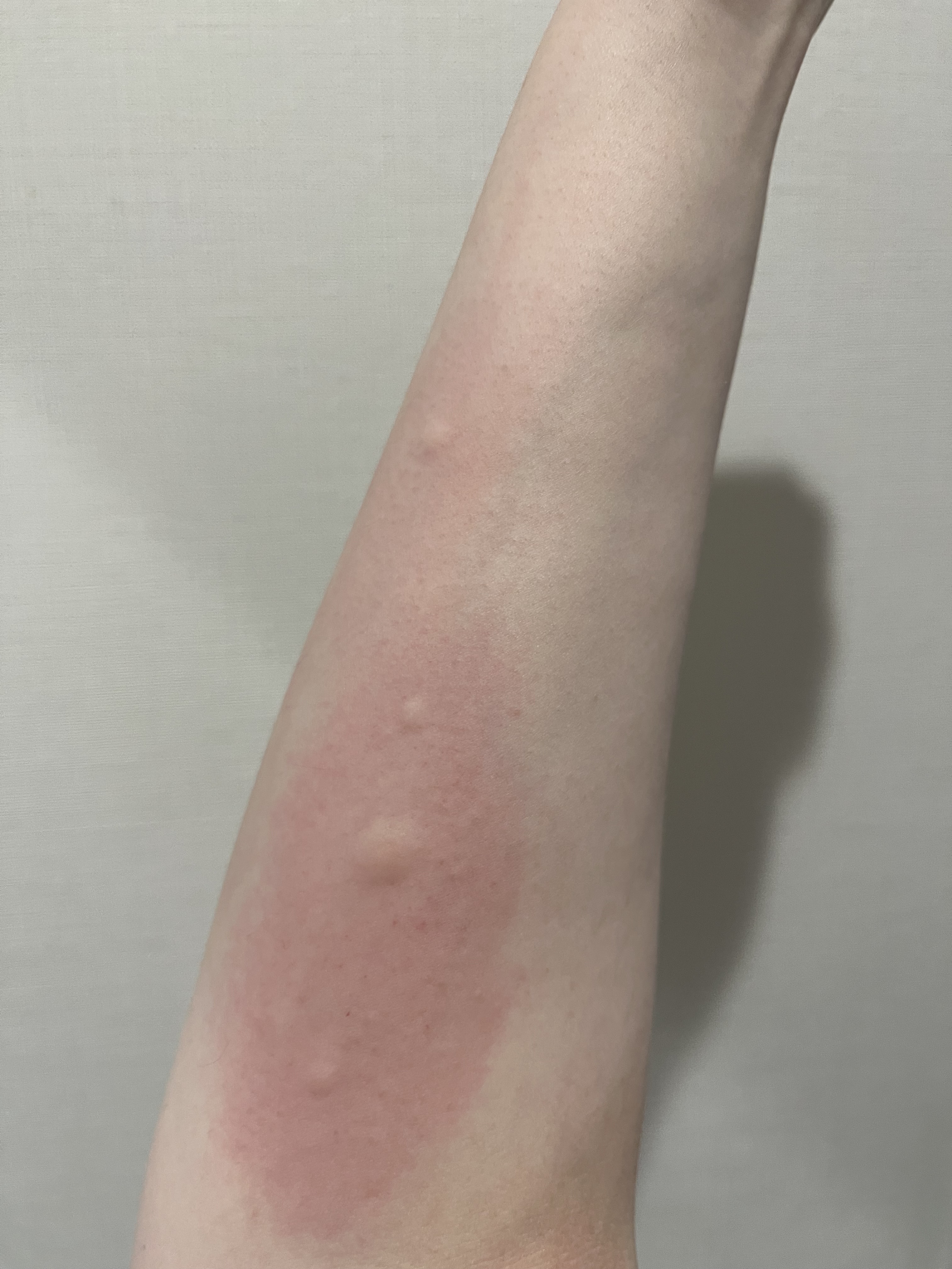 新ウナ コーワ クール(医薬品)/コーワ/その他を使ったクチコミ（2枚目）