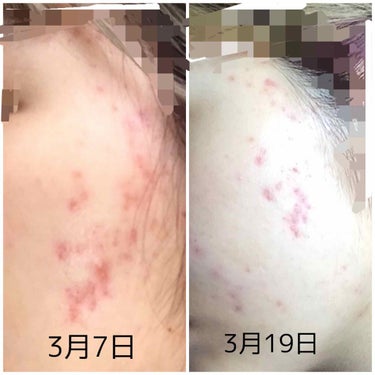 敏感肌用薬用美白美容液/無印良品/美容液を使ったクチコミ（3枚目）