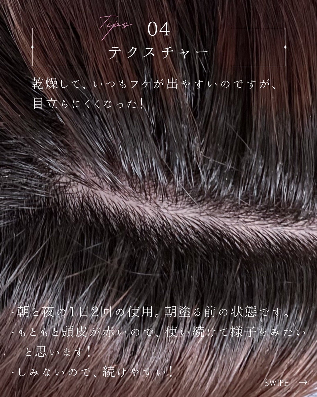 オーリム 育毛剤/OLIM/頭皮ローションを使ったクチコミ(5枚目)