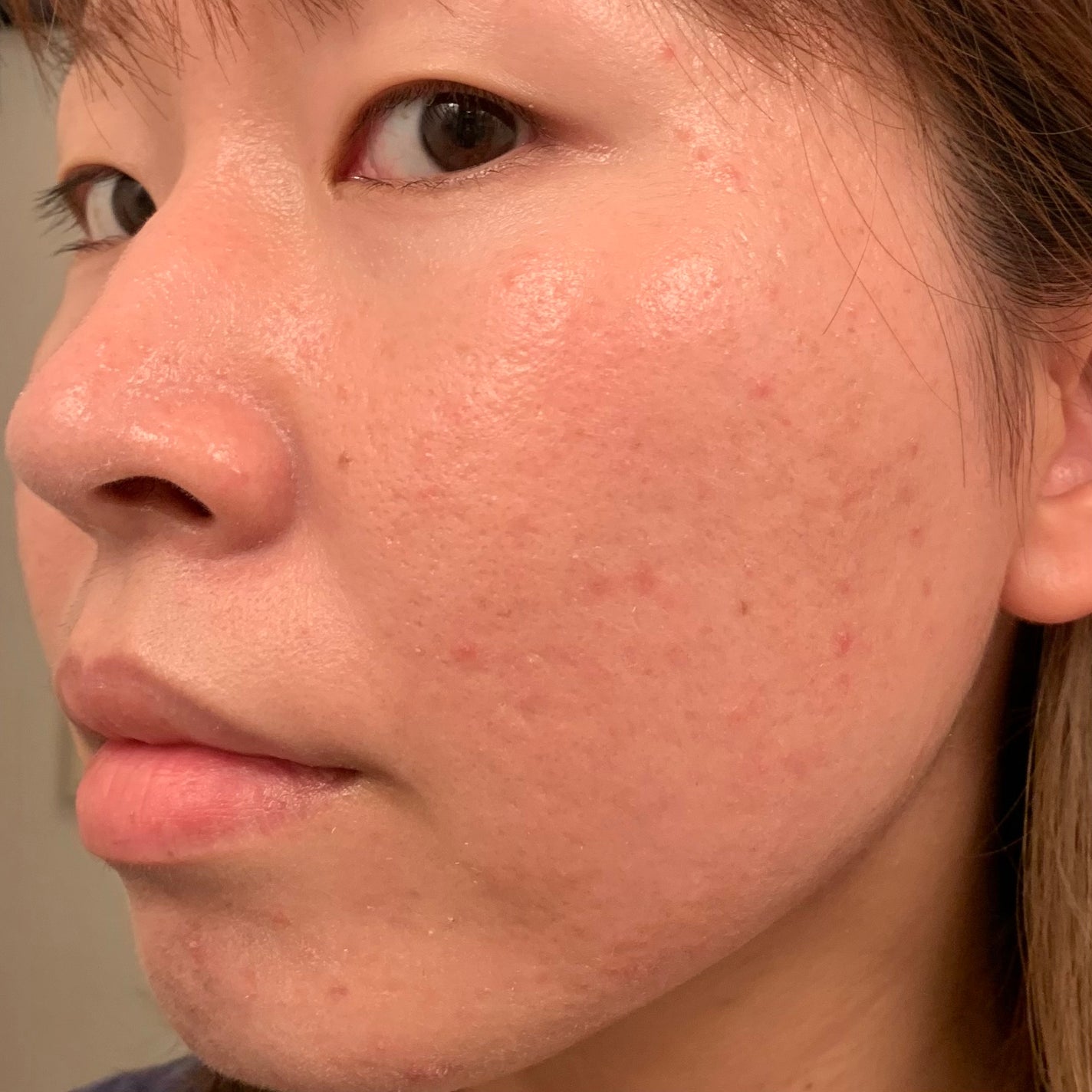 ããŒã¹ ã¯ãªã¢UVãããã¯ã¿ãŒ/ organic/æ¥çŒãæ¢ãã¯ãªãŒã ã䜿ã£ãã¯ãã³ãïŒ8æç®ïŒ