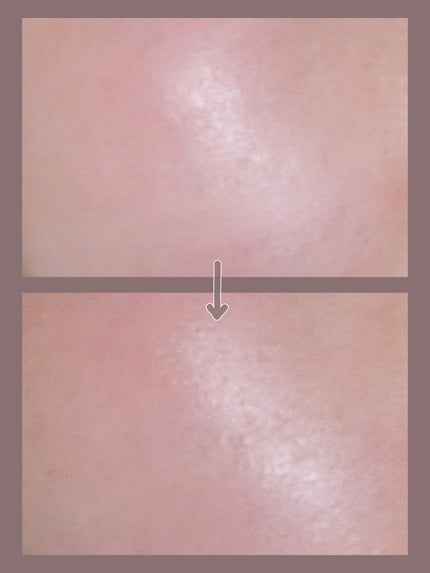 グリーンタンジェリン ビタC ダークスポットケアセラム/goodal/美容液を使ったクチコミ(3枚目)