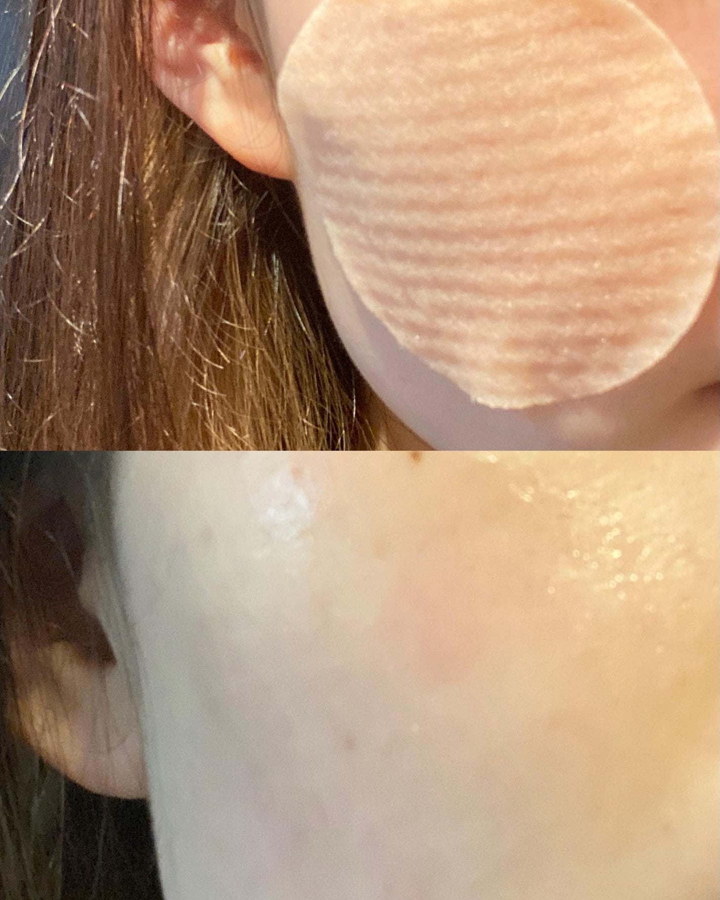 Non/フォロバ100 on LIPS 「4月19日に新発売!@medicube_officialjap..」(3枚目)