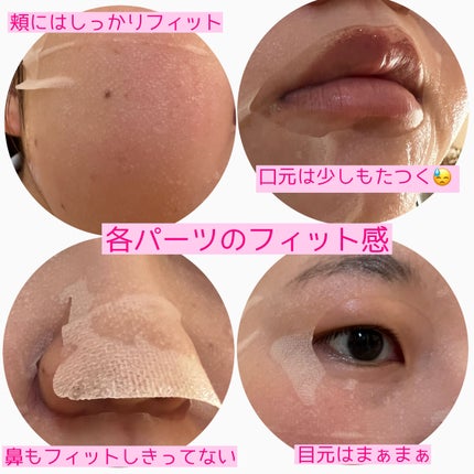 ダーマレーザースーパーVC100マスク/クオリティファースト/シートマスク・パックを使ったクチコミ(3枚目)