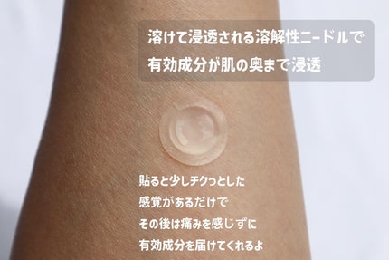 エーキュアショットスポットパッチ/obsero/にきびパッチを使ったクチコミ(4枚目)