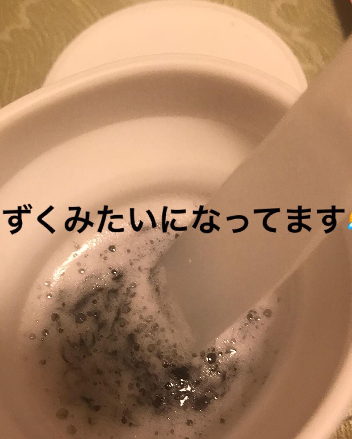 ニードル炭酸パック/NNE/洗い流すパック・マスクを使ったクチコミ(4枚目)