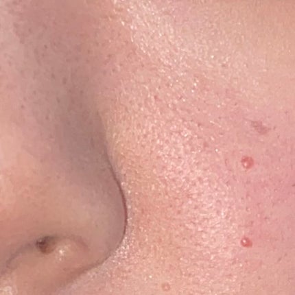 L on LIPS 「毛穴ケアをしてもファンデーションを塗ると毛穴崩れしてしまい小鼻..」(4枚目)