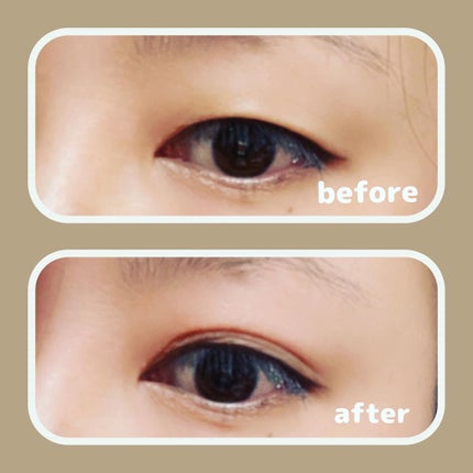 ワンダーアイリッドテープ Extra/D-UP/二重まぶた用アイテムを使ったクチコミ(4枚目)