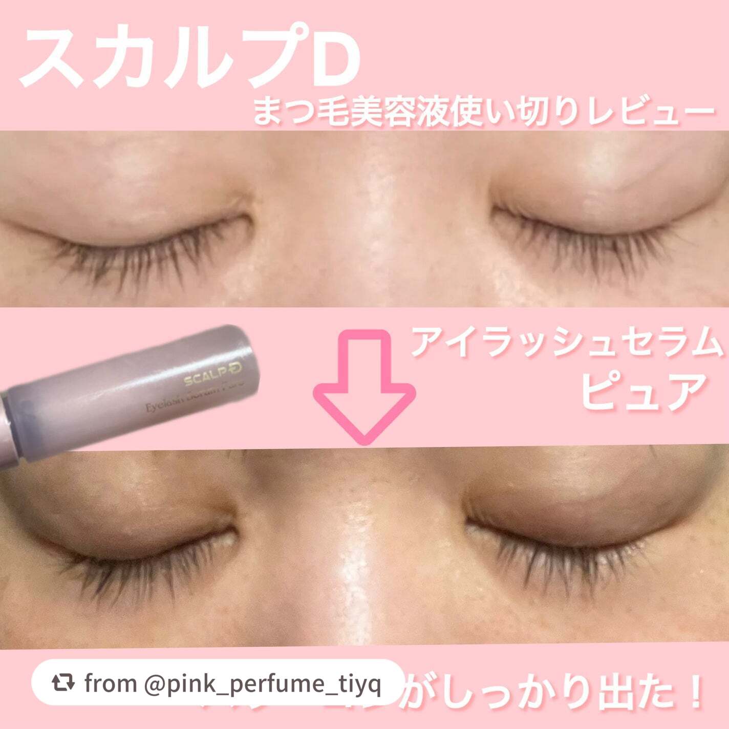 【pink_perfume_tiyqさんから引用】

“#スカルプD #まつ毛美容液 使い切りレビュー
1本1本にしっかりハリとコシを出してくれるまつ毛美容液でした！

－－－－－－－－－－－－－－－－－－－－－－－－－－

【レビュー】
