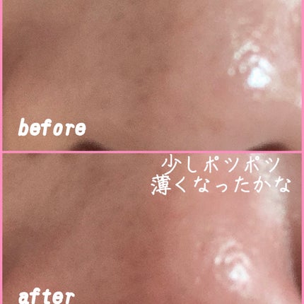 スーパーヴォルカニック ポア クレイマスク 2X スペシャルセット/innisfree/スキンケアキットを使ったクチコミ(5枚目)