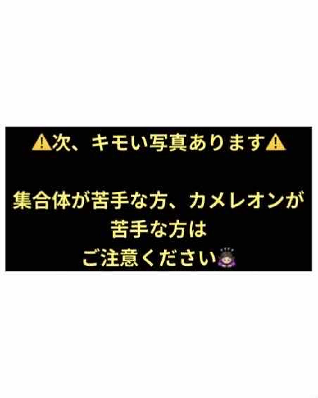 ベビーオイルR/ピジョン/ボディオイルを使ったクチコミ(2枚目)
