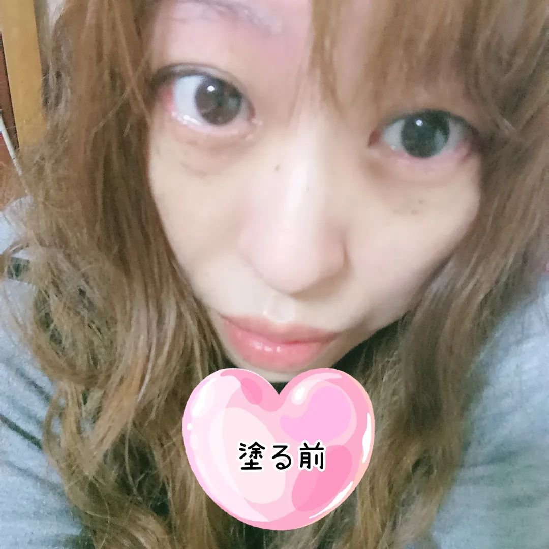 エイシカ365マイクロセラム/AESTURA/美容液を使ったクチコミ（3枚目）