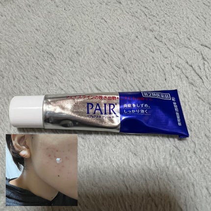 ペアアクネクリームW(医薬品)/ペア/その他を使ったクチコミ(3枚目)
