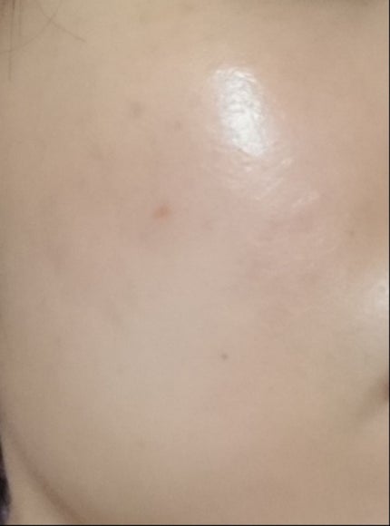 Power10フォーミュラ VCエフェクター/It's skin/美容液を使ったクチコミ(4枚目)