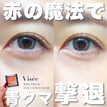 リシェ レッドトリック アイコンシーラー/Visée/パレットコンシーラーを使ったクチコミ(1枚目)