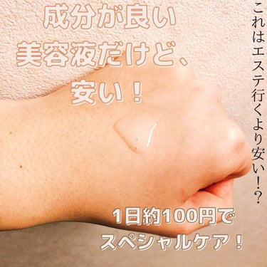 PHOEBE BEAUTY UP セラムショット　Nのクチコミ「PHOEBE BEAUTY UPのSERUM SHOT(美容液)
を定期購入して肌が変わった点.....」（3枚目）