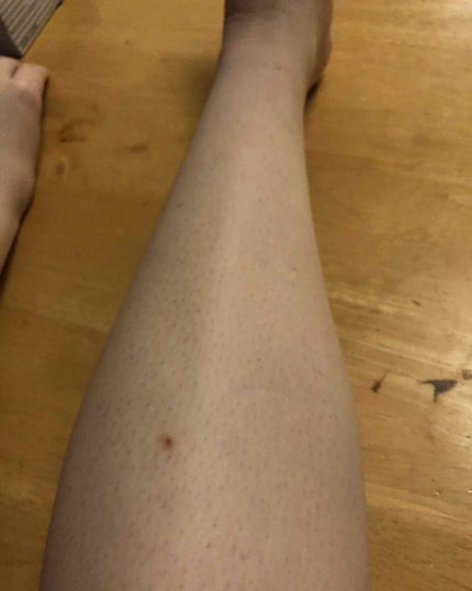 脱毛クリーム MOOMO/自然化粧品研究所/除毛クリームを使ったクチコミ(2枚目)