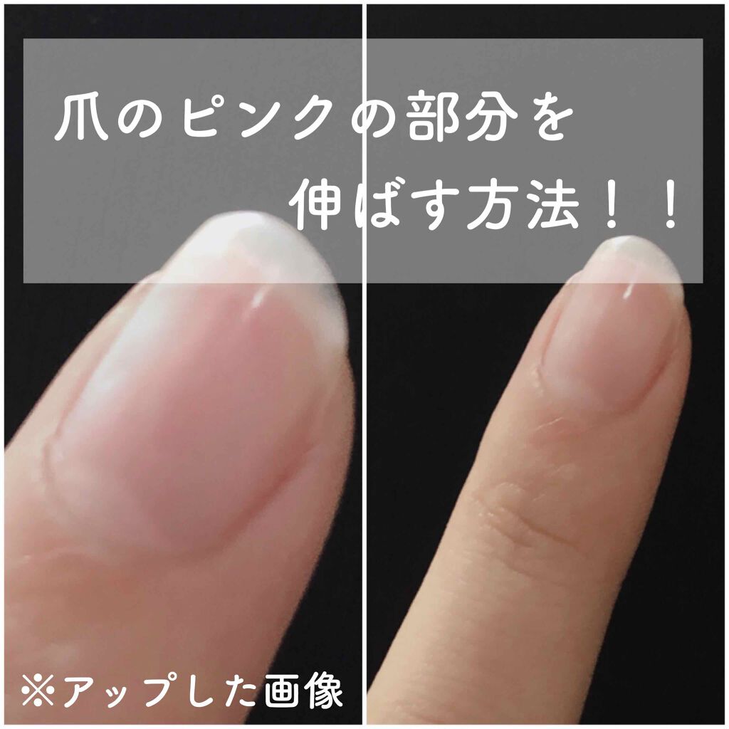ニベアクリーム ニベアを使った口コミ 爪のピンクの部分を長くしたい方必見 それ By りとる 混合肌 Lips ニベアクリーム ニベアを使った口コミ 爪のピンクの部分を長くしたい方必見 それ By りとる 混合肌 Lips