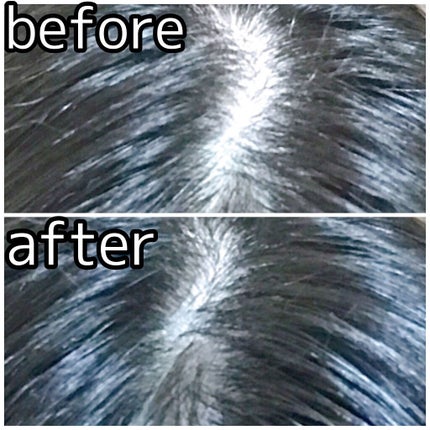 モウダス 薬用 発毛促進剤/北の快適工房/頭皮ローションを使ったクチコミ(5枚目)