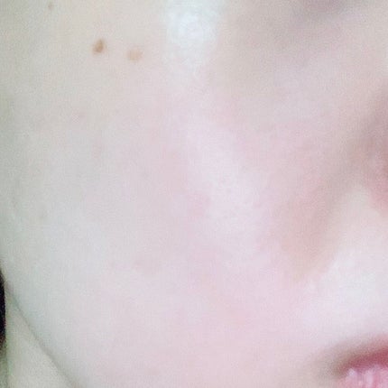 RJローションN/アピセラピーコスメティクス/化粧水を使ったクチコミ(4枚目)