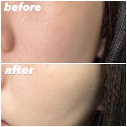 レチノール スーパーバウンス セラム/IOPE/美容液を使ったクチコミ(3枚目)