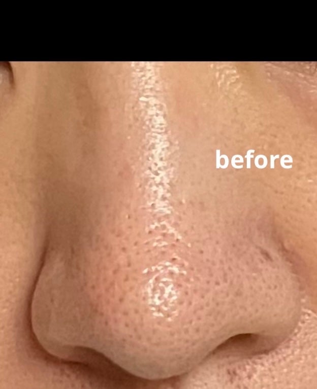 APPプラスローション GOプレミアム/ITO/ブースター・導入液を使ったクチコミ(2枚目)