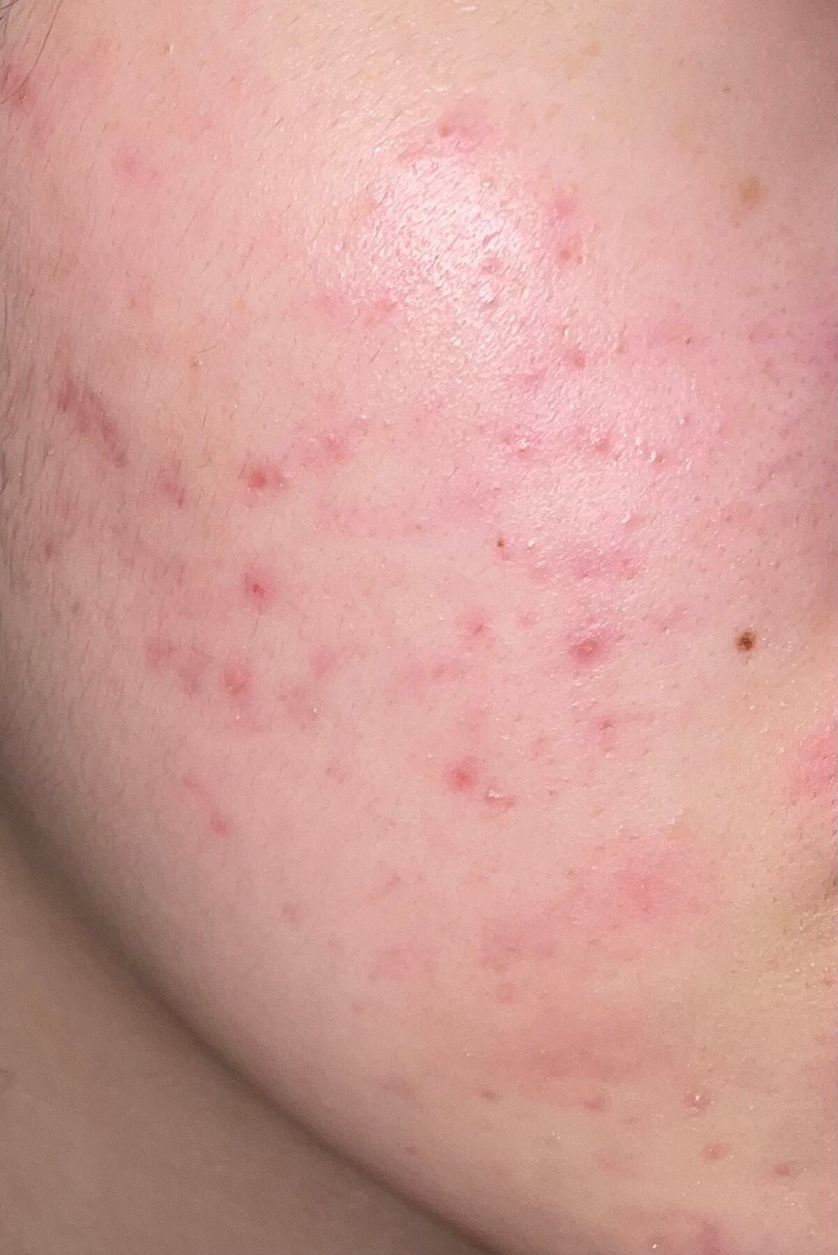 ðŒ on LIPS ã人çã§åããŠãããªã«èããŠãŸãâŠâŠâŠãâ â¡é ¬â¢é¡â£ãã§ããããª..ãïŒ2æç®ïŒ