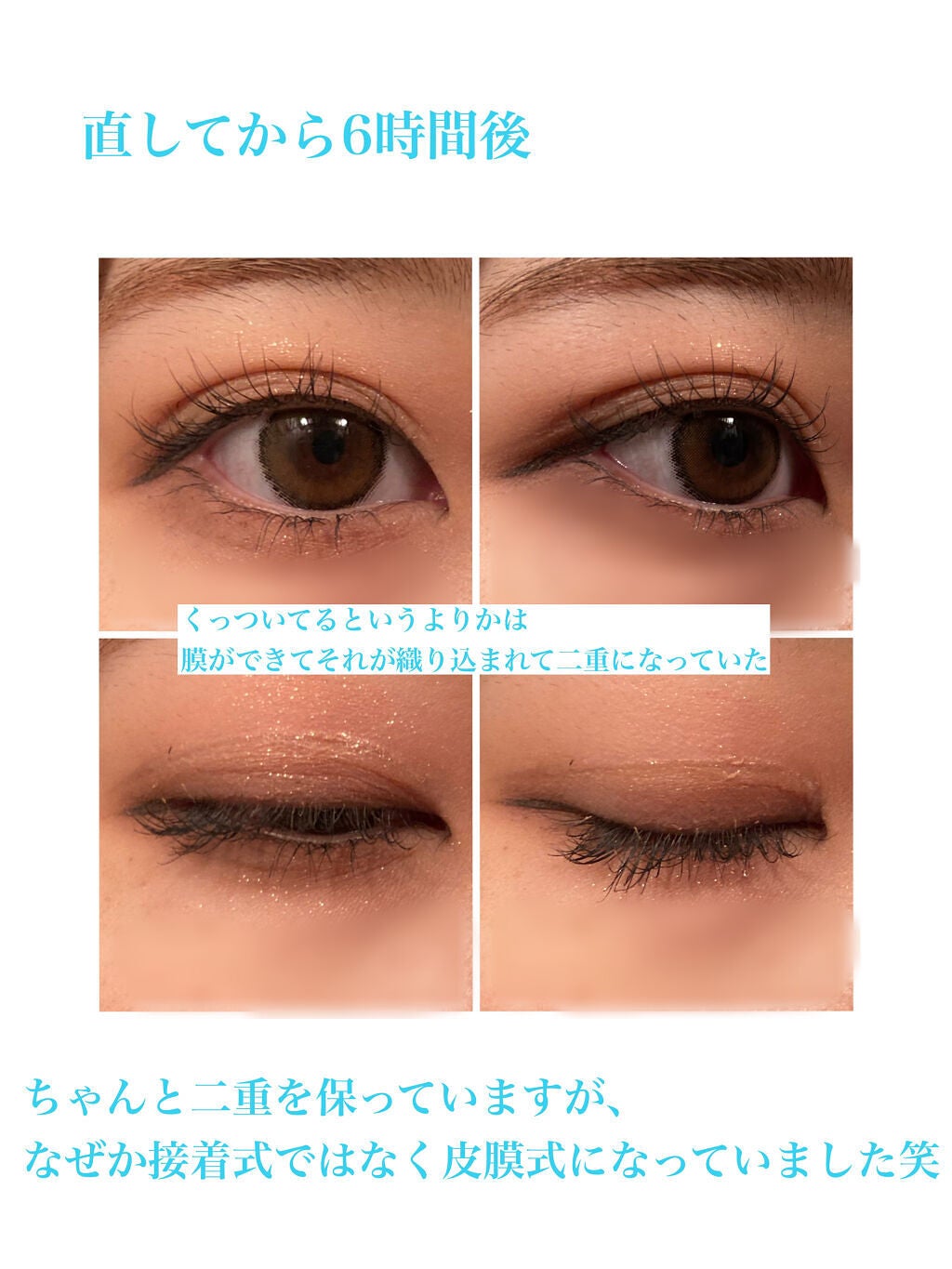 アイトーク スーパーウォータープルーフ/アイトーク/二重まぶた用アイテムを使ったクチコミ(7枚目)