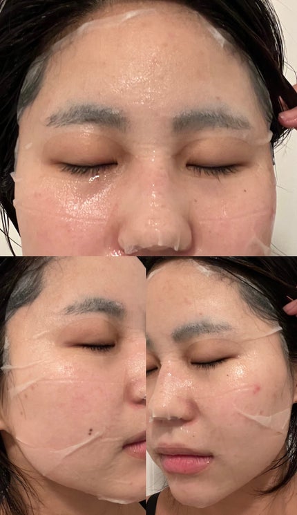 レチビタエッセンスマスク/ピュレア/シートマスク・パックを使ったクチコミ(3枚目)