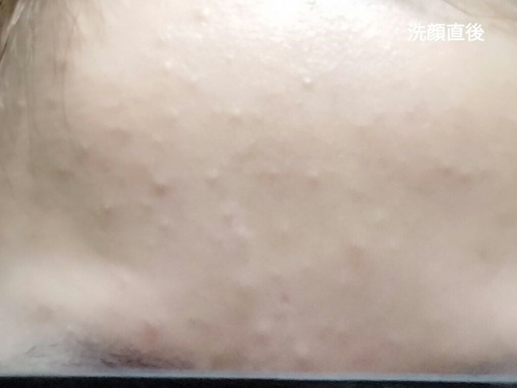 エンハンサー/ニュースキン/美容液を使ったクチコミ(3枚目)