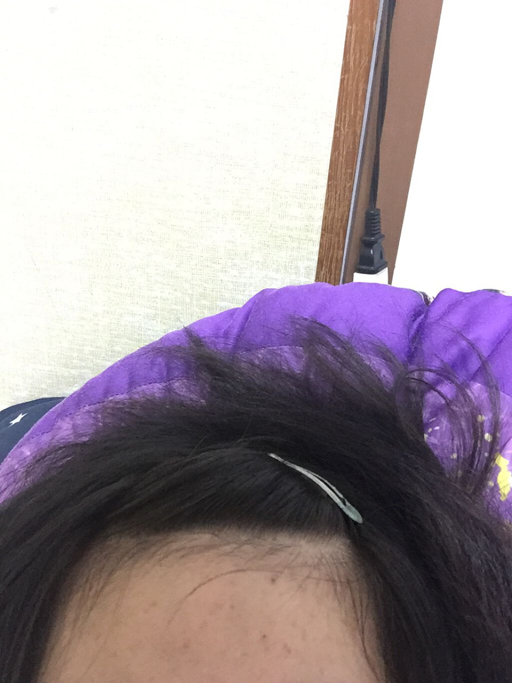 オリジナル ピュアスキンジェリー/ヴァセリン/ボディクリームを使ったクチコミ（1枚目）