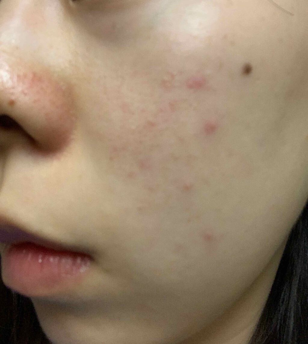 つき on LIPS 「コロナ自粛で、1ヶ月、人に会う予定がないので肌断食してみる。い..」(1枚目)