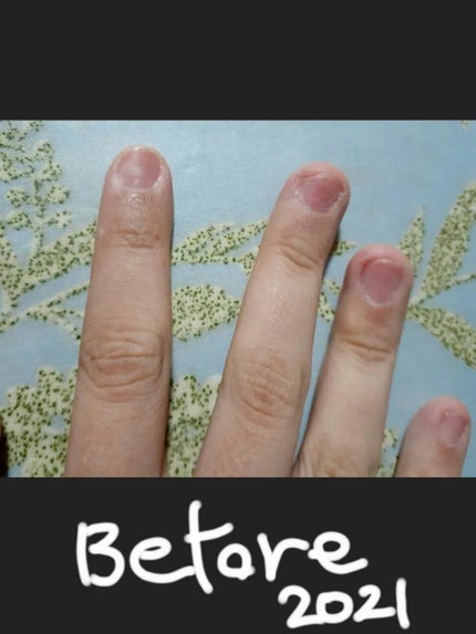 ネイルケアオイル/無印良品/ネイルオイル・トリートメントを使ったクチコミ(1枚目)