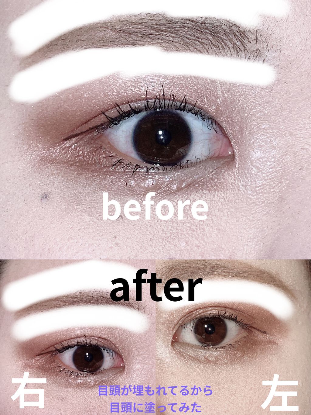 オリシキ アイリッドスキンフィルム		/D-UP/二重まぶた用アイテムを使ったクチコミ（2枚目）