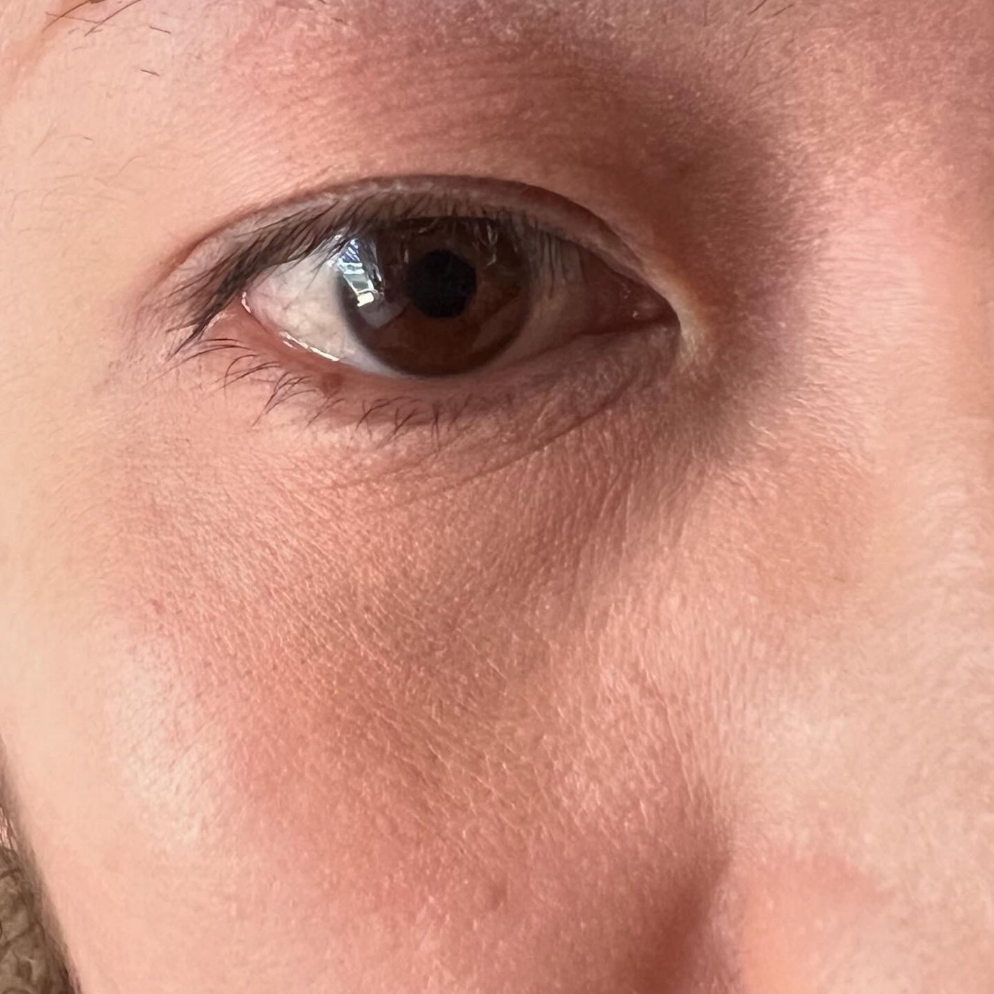 デイジードール コンシーラー パレット/DAISY DOLL by MARY QUANT/パレットコンシーラーを使ったクチコミ(7枚目)