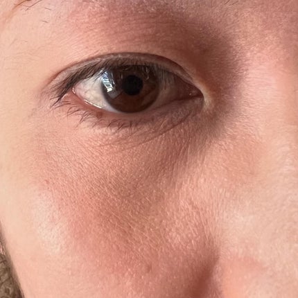 デイジードール コンシーラー パレット/DAISY DOLL by MARY QUANT/パレットコンシーラーを使ったクチコミ(7枚目)