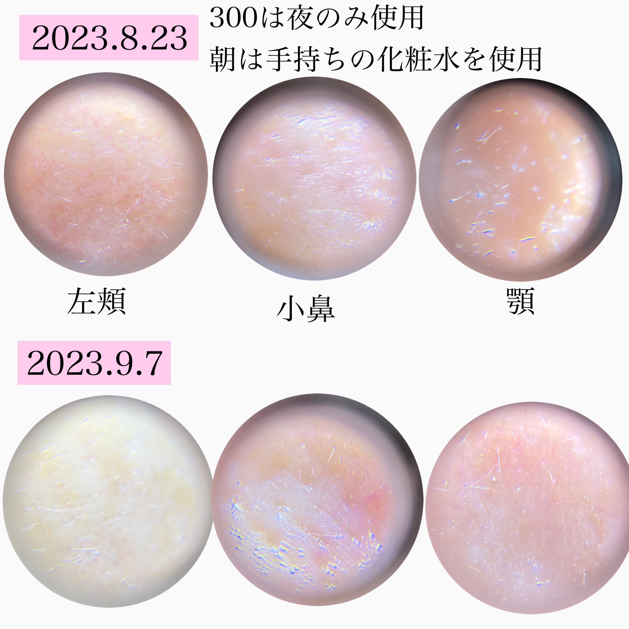 リードルショット300/VT/美容液を使ったクチコミ（3枚目）