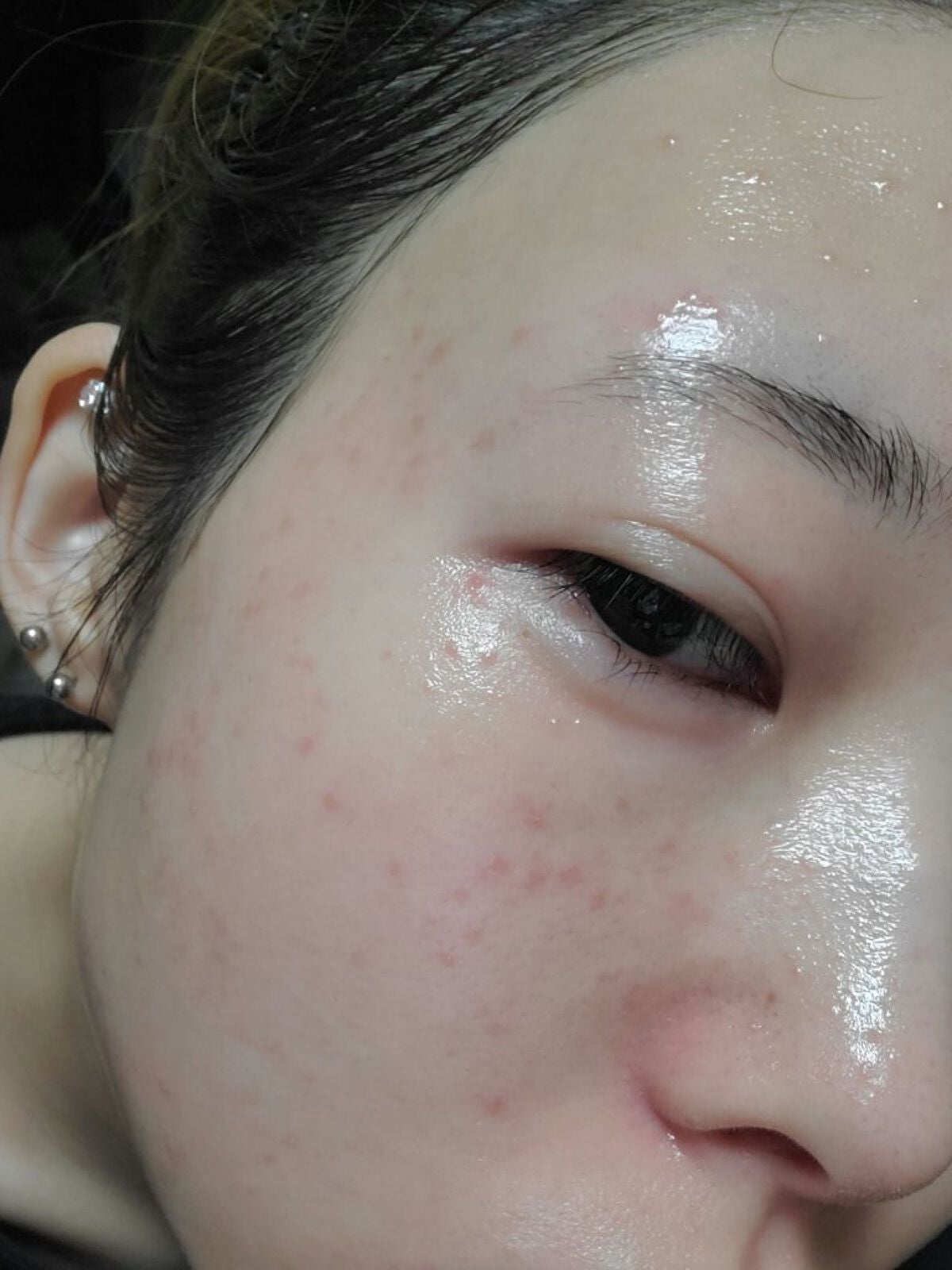 プロシカ センテラアジアチカ タイガーアンプルマスク/VT/シートマスク・パックを使ったクチコミ(2枚目)