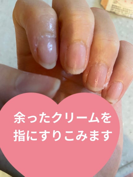 ネイルホリック リミテッドカラー Popping Sugar/ネイルホリック/マニキュアを使ったクチコミ(6枚目)